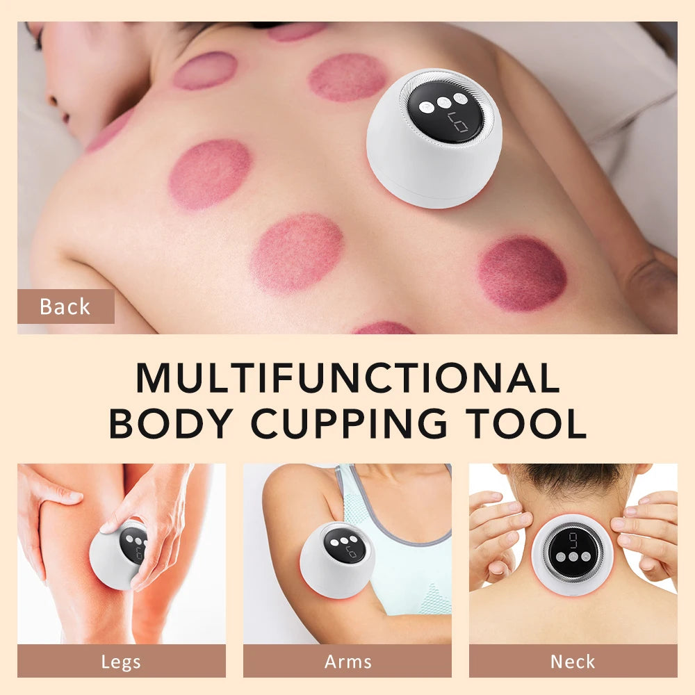 FS Recovery Cupper Pro